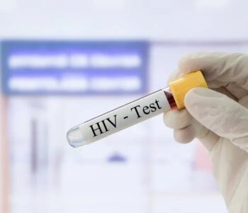 HIV testing in Singapore for women