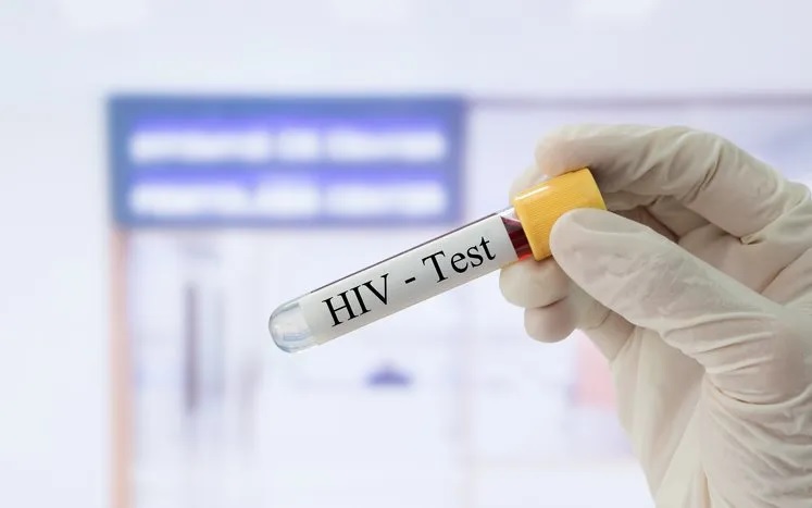 HIV testing in Singapore for women